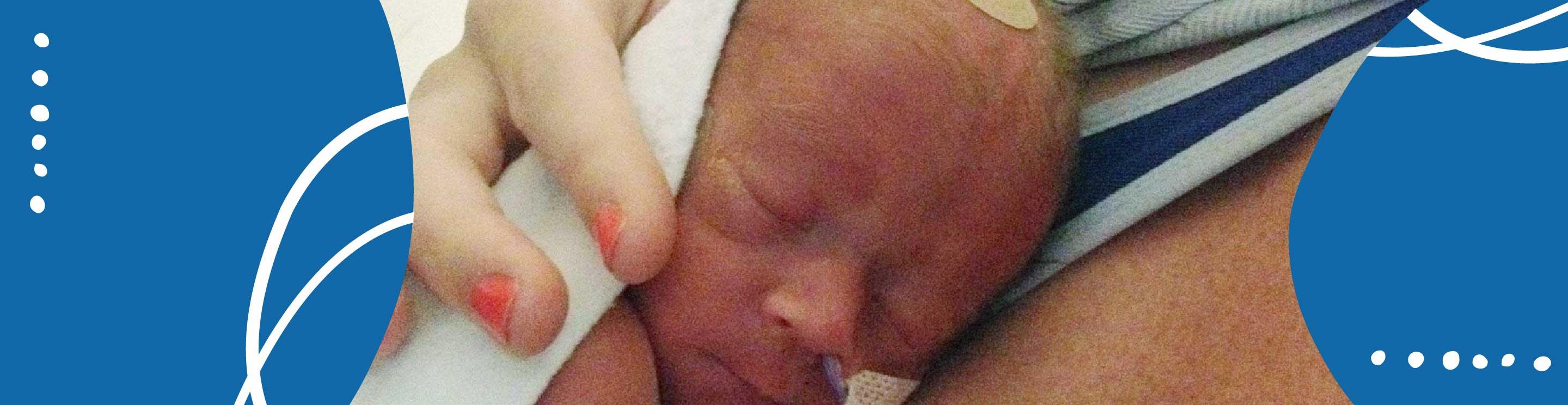 Grady, IWK Patient