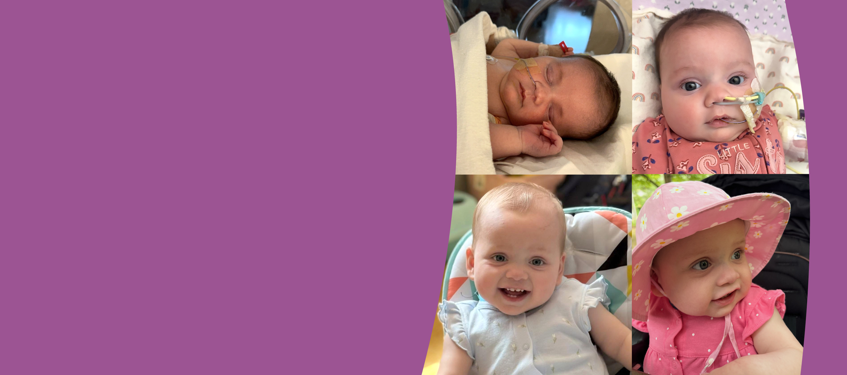 Collage showing a baby’s recovery from hospital care to happy, healthy moments.