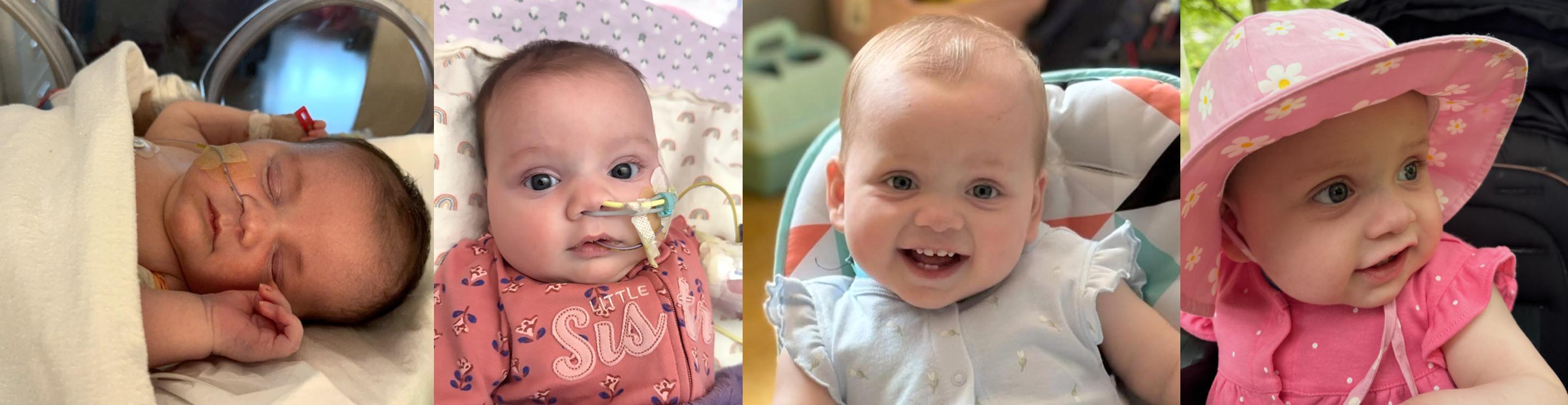 Four photos showing a baby girl’s journey from newborn in hospital care with tubes to a smiling, healthy toddler wearing a pink sun hat.