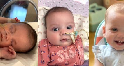 Four photos showing a baby girl’s journey from newborn in hospital care with tubes to a smiling, healthy toddler wearing a pink sun hat.